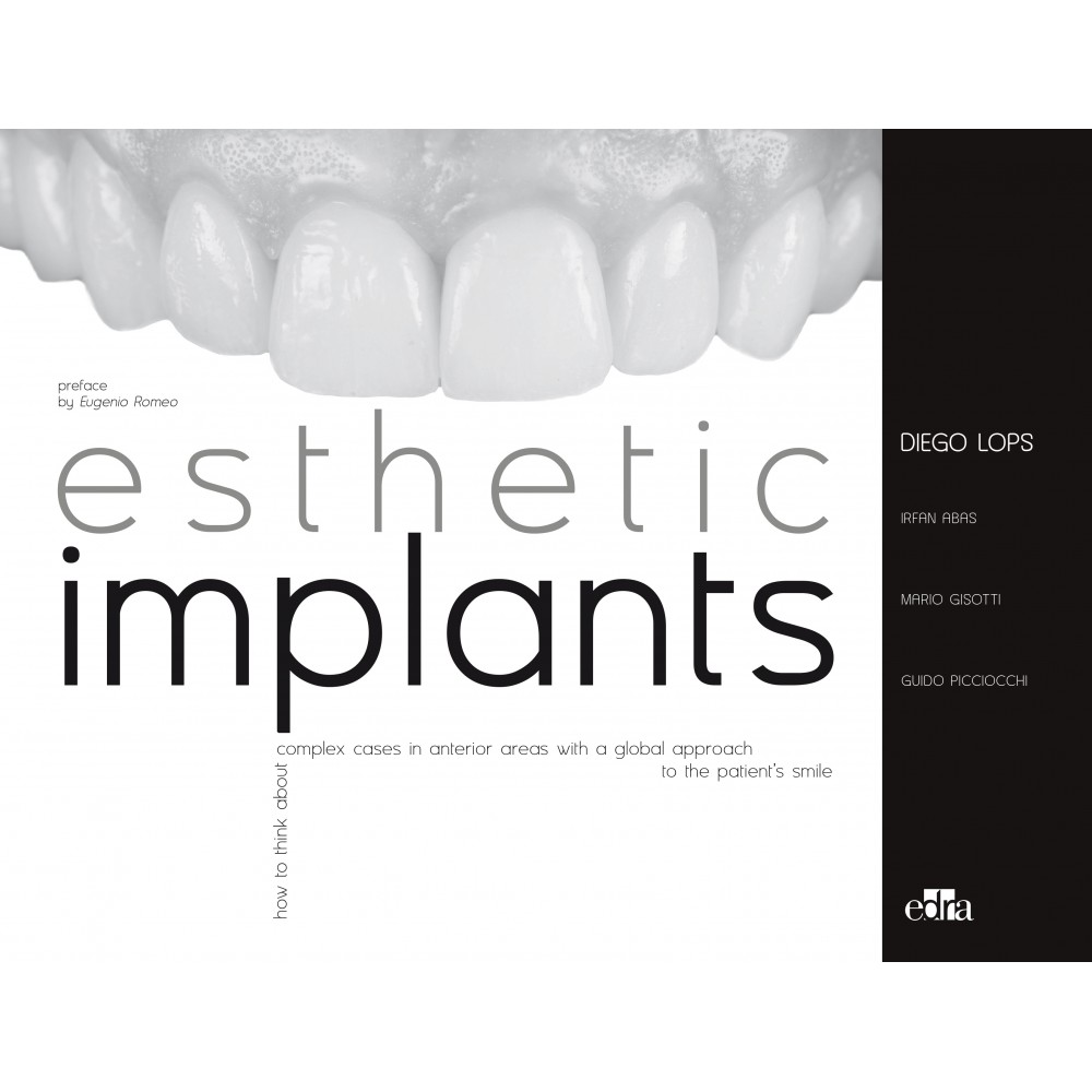 esthetic-implants-how-to-think-about-complex-cases-in-anterior-areas-with-a-global-approach-to-the-patient-smile